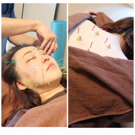  FUTS鍼灸整体院 美容鍼（全身コース）のメニュー画像