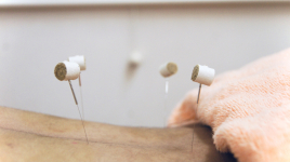 西安堂サロン 総合治療コース　鍼灸・整体のメニュー画像