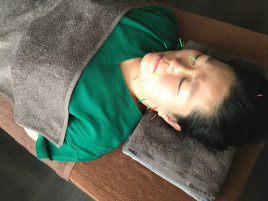 西安堂サロン 美容鍼のメニュー画像