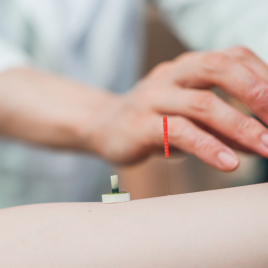 HARIN 身体部分鍼のメニュー画像