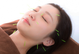 りりあタウン整骨院 美容鍼(初回限定50%off)のメニュー画像