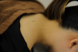 オリーブ鍼灸整骨院 初回お身体の鍼灸のメニュー画像