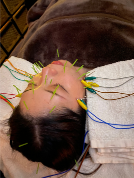 美容・鍼灸サロンS４ 通電（オプション）のメニュー画像