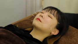 オリーブ鍼灸整骨院 審美はりのメニュー画像