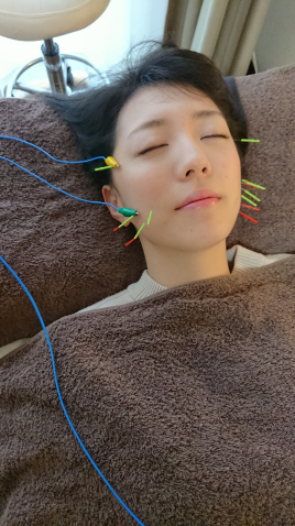 Slowstyle&麗美鍼灸院 美容鍼　小顔リフト　のメニュー画像