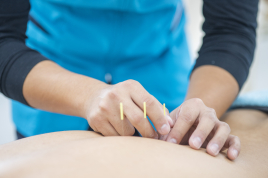 ペガサス鍼灸接骨院 【2回目以降】鍼灸１部位のメニュー画像