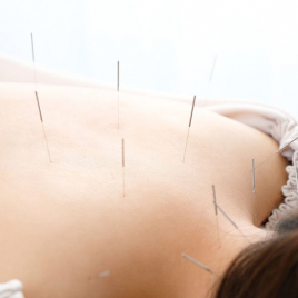 アイメディカル鍼灸整骨院 自律神経（鍼灸治療）のメニュー画像