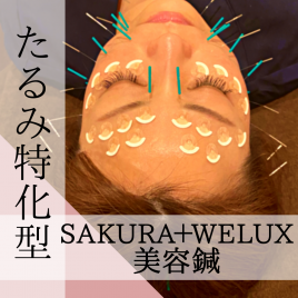 美容鍼灸サロンwelux 【人気】たるみ特化型美容鍼のメニュー画像
