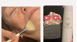 美容鍼,小顔矯正のすぎ治療院 美容鍼&クレイパック&炭酸パック&整体のメニュー画像
