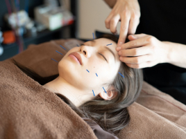 鍼灸サロンRestore お試し美容鍼のメニュー画像