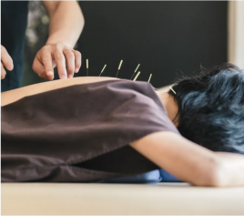 神谷澤鍼灸整骨院 鍼灸治療のメニュー画像