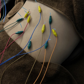 鍼灸サロン 悠雲 【身体の内側から弛める】全身鍼治療のメニュー画像