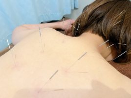 鍼灸＆ボディケアサロン大濠ベッラ 鍼灸治療（自律神経を整える）のメニュー画像