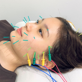 美容鍼実技 4枚セット 大宝 DSP-4(50) | 全医療器