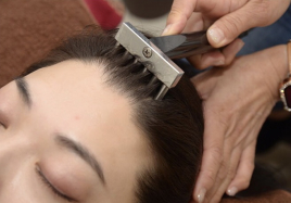 美容鍼灸サロン　プティ・エシェル 育毛鍼のメニュー画像