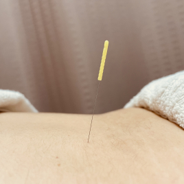 新発田名倉堂鍼灸接骨院 鍼　半身治療のメニュー画像