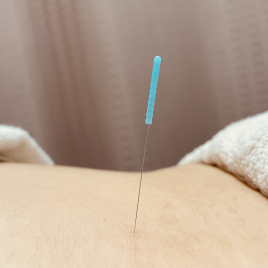 新発田名倉堂鍼灸接骨院 鍼　全身治療のメニュー画像