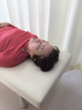 庚午町のかとう鍼灸院 【気軽に】クイック美容鍼灸【安価で】のメニュー画像