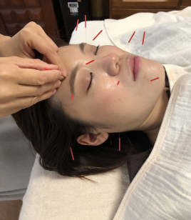 yohaku.　鍼灸treatment salon 【美容鍼＋お身体】＆オイルトリートメントのメニュー画像