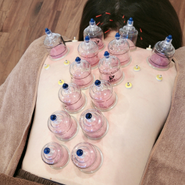 cocori鍼灸院 カッピング+頭皮鍼のメニュー画像