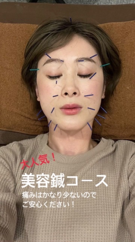 鍼灸マッサージYOKAanbe 美容鍼灸のメニュー画像