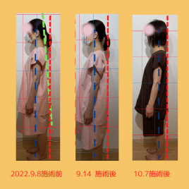 鍼灸院 Revive（リバイブ） 脊柱管狭窄症のメニュー画像