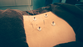 猫ノ手鍼灸治療院 【腰痛でお悩みの方に！】鍼灸施術のメニュー画像