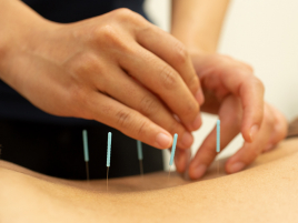 かきざわ鍼灸指圧マッサージ院 鍼灸（2回目以降の方）のメニュー画像