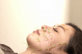 美容鍼専門店　Hari-jo　千歳烏山店 Harijoコース60分(美容鍼+小顔)のメニュー画像