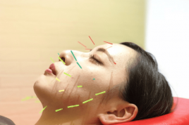 美容鍼専門店　Hari-jo　千歳烏山店 Hari姫コース120分のメニュー画像