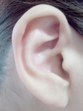 まるめ鍼灸治療院 耳介治療（耳ツボ）のメニュー画像