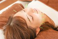 みらいはりきゅう整骨院 美容鍼のメニュー画像