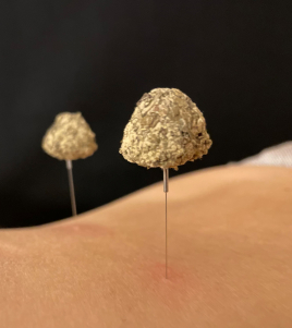 鍼灸専門 一齊堂 【温灸】灸頭鍼のメニュー画像