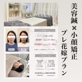 美容鍼灸整体 HARIKA 大阪 心斎橋店  No.１☝美容鍼×小顔矯正【花嫁プラン】のメニュー画像