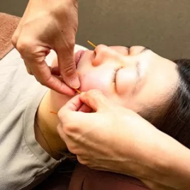 さくら整骨院 初回限定　美顔鍼&オイルベーシックコースのメニュー画像