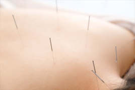 鍼灸サロン SHINSHIN Lab 豪徳寺 ■お身体の鍼灸のメニュー画像