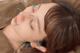 Merci Okinawa🌸美容鍼灸サロン 【初回限定】美容鍼灸のメニュー画像