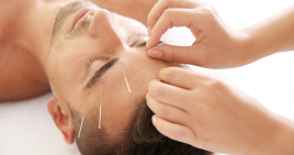 アイメディカル鍼灸整骨院 美容鍼・美容鍼灸（プレミアムコース）のメニュー画像