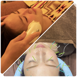 Relama美容鍼✕マッサージ 【ご新規様限定】美容鍼×セルキュアエステのメニュー画像