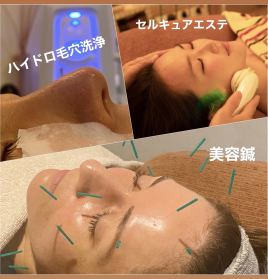 Relama美容鍼✕マッサージ 【ご新規様限定スペシャルコース】のメニュー画像