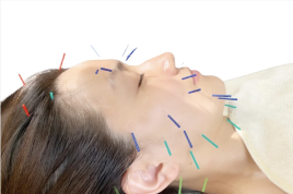 鍼灸サロンZouzou(ずず)  【人気】本格全身鍼灸＆オイル美容コースのメニュー画像