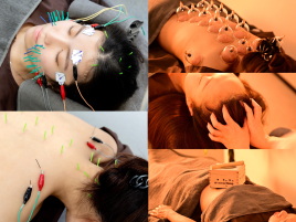 hari salon de off 心斎橋店 【2週間以内限定】極上贅沢美容鍼のメニュー画像