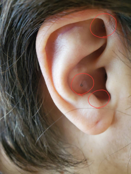 めい治療院 耳鍼のメニュー画像