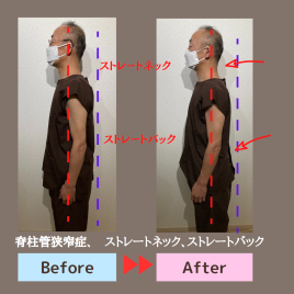 鍼灸院 Revive（リバイブ） 鍼灸・整体・マッサージ　6０分のメニュー画像