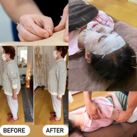 ホジュン鍼灸整体院 美容鍼+鍼灸+整体のメニュー画像