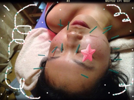 なでしこ治療院 美顔鍼灸のメニュー画像