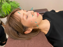 nanohana鍼灸サロン 美容鍼のメニュー画像