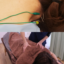 こばやししんきゅう 鍼灸治療 ショート(局所)+ほぐしのメニュー画像