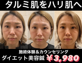 メニュー写真