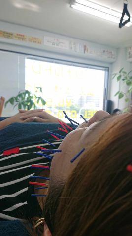 川端七条鍼灸整体院 美容鍼+お顔整体のメニュー画像